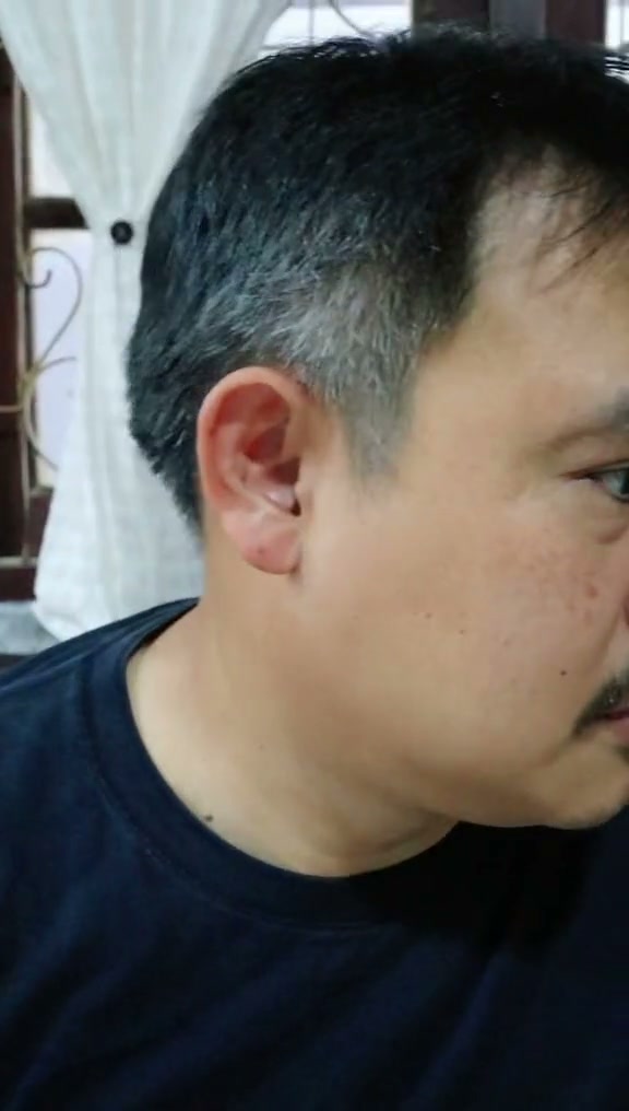 โคนผมขาวก่อนใช้
